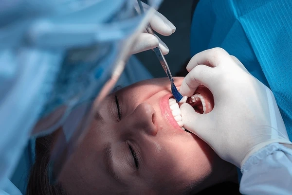 dental crowns in marpole bc