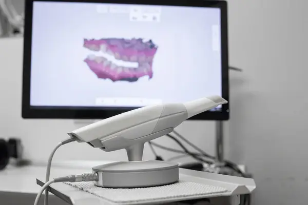 itero scanner in marpole bc
