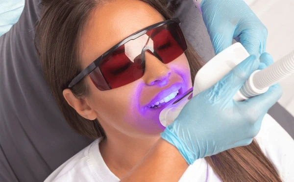 teeth whitening near you