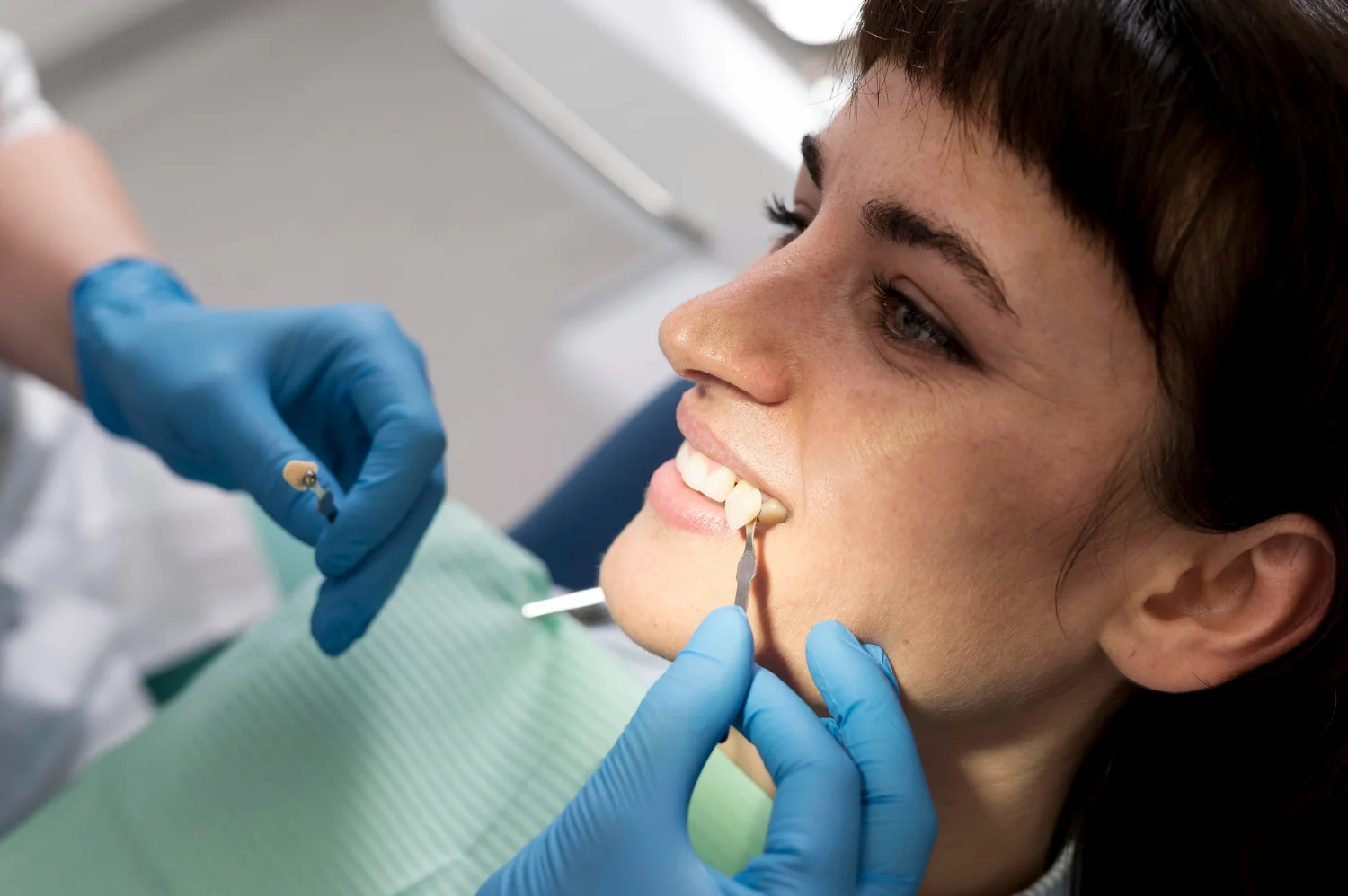 minish dental veneer in marpole bc