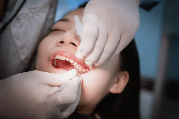 wisdom teeth extraction in marpole bc